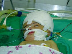 Little Manar has survived the operation and looks set for recovery.